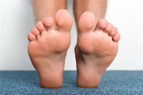 How Having Flat Feet Can Cause Foot Problems Chicagoland Foot And