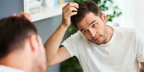 Why Men Go Bald And What To Do About It Askmen