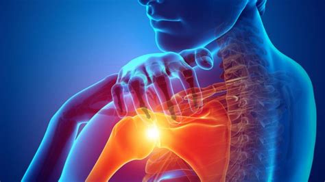 Shoulder Pain From Lifting Root Causes And Treatment