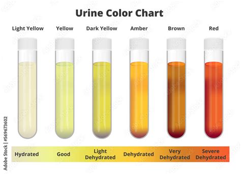 Naklejka Urine Color Chart Vector Test Tubes With Different Colors Of Urine Or Pee Depicting