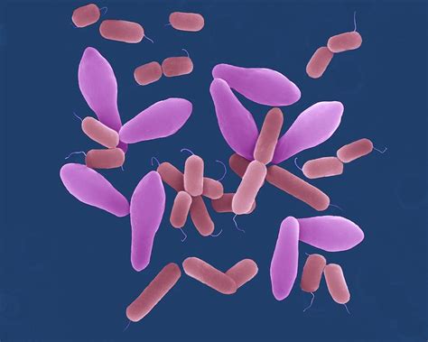 Clostridium Perfringens Photograph By Dennis Kunkel Microscopy Science My Xxx Hot Girl