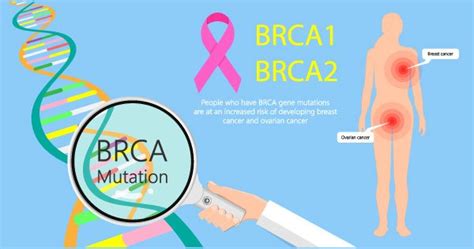 The Brca1 And Brca2 Gene Mutations Kill Post Mortem Dna Testing Saves Lives