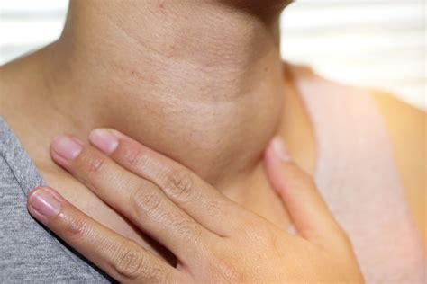 8 Best Natural Remedies For Goiter Heal Goiter With Herbs