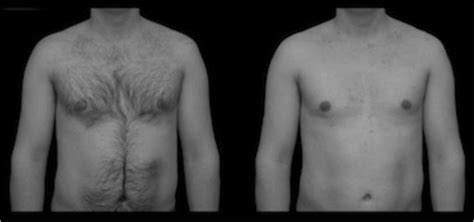 An Example Of The Body Hair Stimuli Used In This Study Images Show The