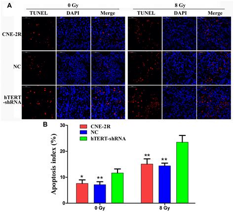 Silencing Htert Attenuates Cancer Stem Cell Like Characteristics And