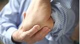 Can I Go On Disability For Rheumatoid Arthritis