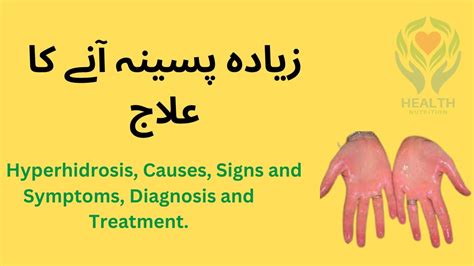 Hyperhidrosis Causes Signs And Symptoms Diagnosis And Treatment