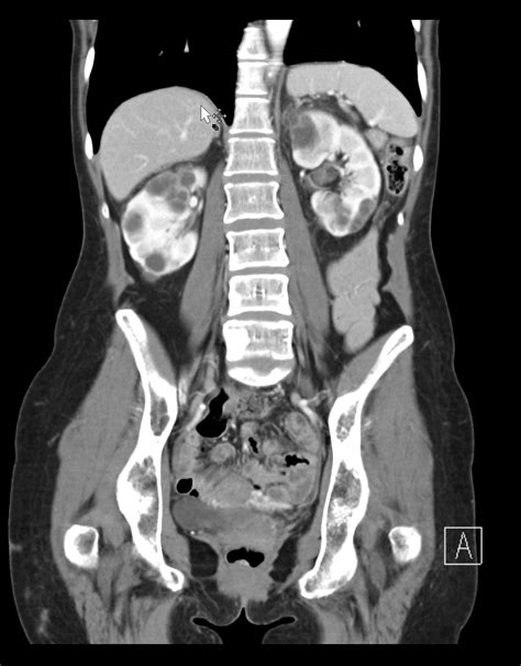 Abdominal And General Body Imaging Department Of Radiology College