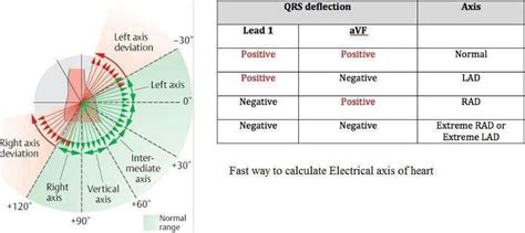 Fast Way To Calculate Electrical Axis Of Heart