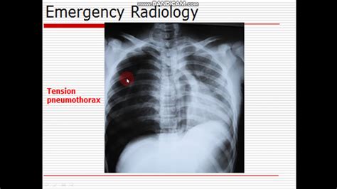 Emergency Radiology Part 9 Youtube