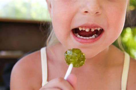 Nearly A Third Of Five Year Olds In England Has Tooth Decay Study