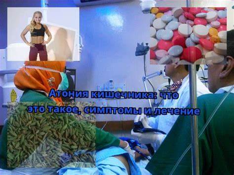 Атония кишечника лечение диета Атония кишечника - причины, симптомы и лечение: Прозерин, Пилокарпин Атония кишечника - причины, симптомы и лечение: Прозерин, Пилокарпин Атония кишечника лечение диета
