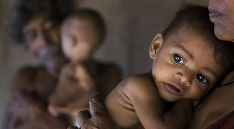 The Growing Burden Of Child Malnutrition In India Spontaneous Order