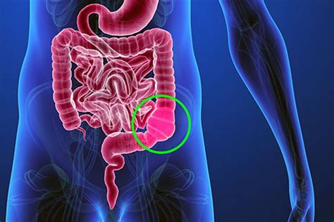 Your first instinct when you're in this predicament might be to reach for a laxative. 7 Foods You Should Never Eat When You're Constipated