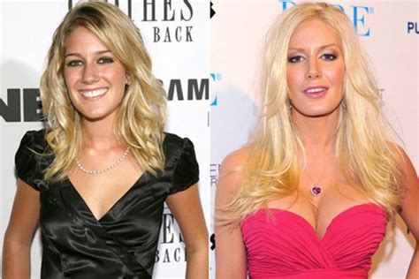 The Ever Changing Look Of Heidi Montags Before And After Plastic