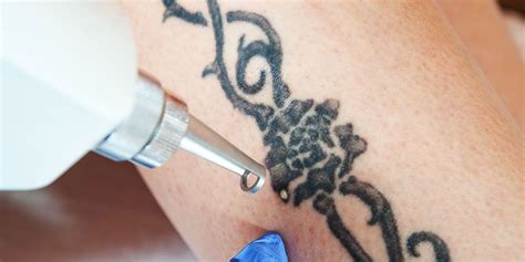 Salt is used in most of the natural diy's of removing tattoo in home. How to Remove Your Tattoo | Men's Health