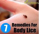 Home Remedies For Body Lice Pictures Photos