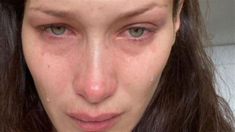 bella hadid posts crying photos on instagram to highlight mental health struggles perthnow