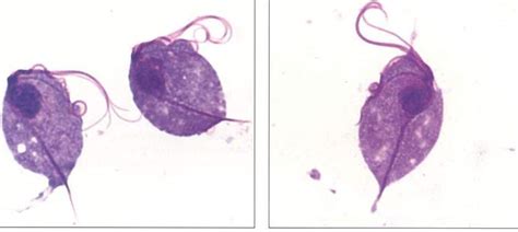 Parasito S Trichomonas Vaginalis