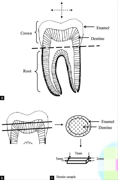 Schematic Diagram Of The Longitudinal Section Of A Molar Tooth Showing