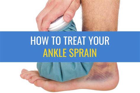 Ankle Sprain Treatment Sprained Ankle Exercises Sports Injury Physio