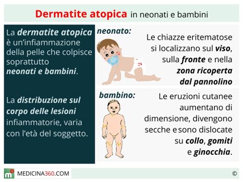 Dermatite Atopica Alimentazione Consigliata