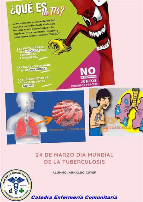 El D A De Hoy Se Conmemora El D A Mundial De La Tuberculosis Cuyo Lema
