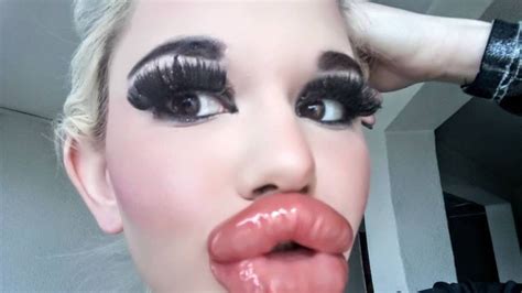 Womans Extreme Effort To Have Worlds Biggest Lips Andrea Ivanova Gets 20 Fillers Nz Herald