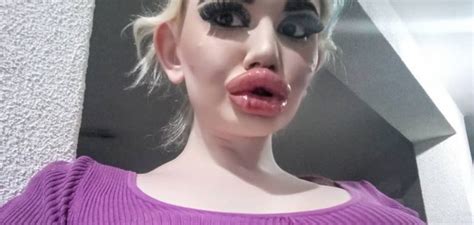 This Woman Has Spent Thousands On Trying To Get The Biggest Lips In