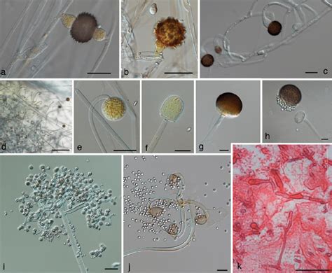 Rhizopus Mycelium Zygospores