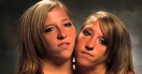21 years after we met conjoined twins abby and brittany they are all grown up doyouremember