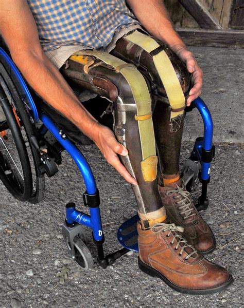 Modern Wheelchair Meets Vintage Double Above Knee Prosthetic Legs
