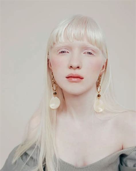 Pretty People Beautiful People Modelo Albino Albino Model Albino