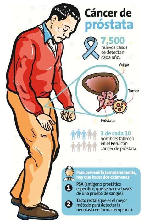 Cáncer De Próstata Es El Que Más Crece Salud Peru21