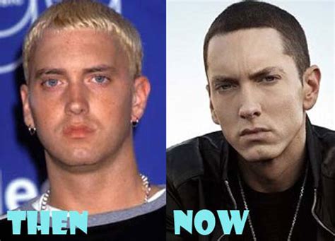 Eminem Plastic Surgery Before And After Top Piercings