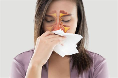 No Stuffy Noses Allowed Sinus Treatment From Excel Ent Of Birmingham Al