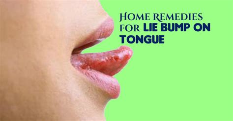 7 Home Remedies For Lie Bumps On Tongue With Video