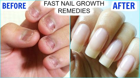 aggregate more than 155 tips to make nails stronger vn