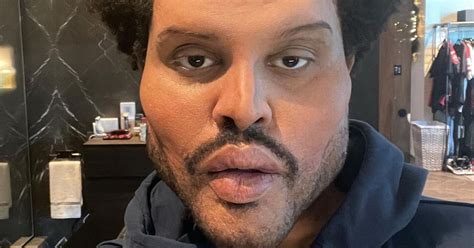 The Weeknds Fans Savagely Think He Modelled Plastic Surgery Face On