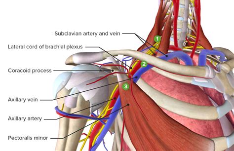 Thoracic Outlet Syndrome Concise Medical Knowledge