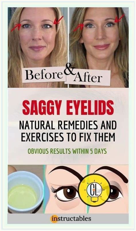 Natural Remedy For Sagging Eyelids Sagging Eyelids Exercise How To Hot Sex Picture