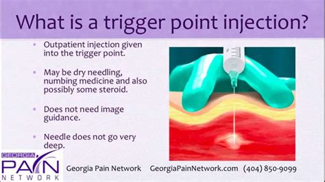 Trigger Point Injections At The Top Georgia Pain Management Clinics