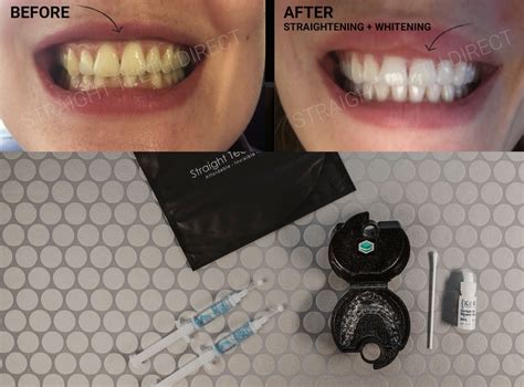 Premium Teeth Whitening Straight Teeth Direct