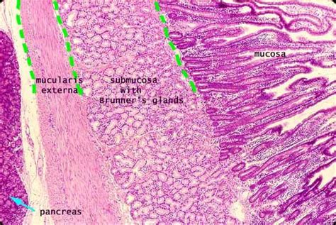 Pin On Histology Small Intestine
