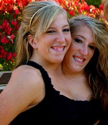 20 Interesting Things About Famous Conjoined Twins Abby And Brittany