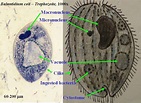 kidney bean-shaped of Balantidium coli cyst | Medical Laboratories