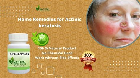 Take Advantages Of Actinic Keratosis Home Remedies To Treat Skin Bumps