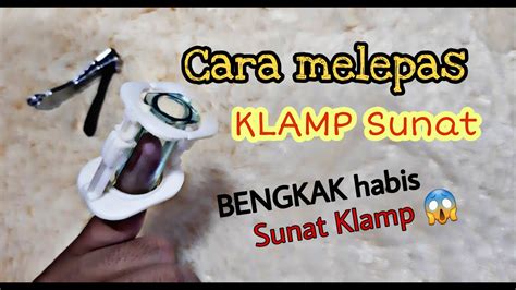 The last session cerita pengalaman sunat klamp. Cara Melepas Klamp Sunat - YouTube