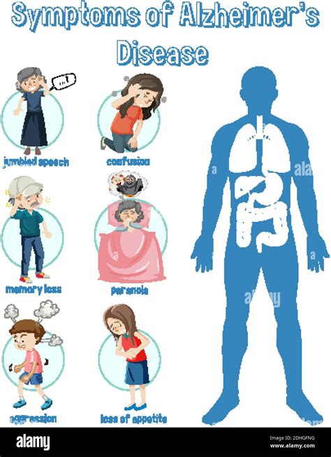 Symptoms Of Alzheimers Disease Infographic Illustration Stock Vector