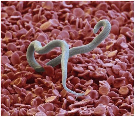Lymphatic Filariasis Worm